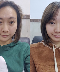 用仪器就直接提拉紧致,我简直惊呆了