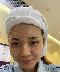 记录人生第一次医美!毛孔粗大的痘肌锁定这个项目