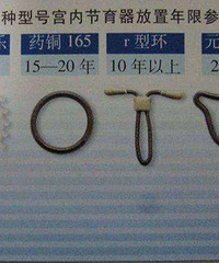 节育环是有保质期的,有人带了16年,环已经长到肉里面去了