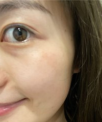 实力种草!做完我的肤色亮了一个度,连老公也忍不住体验了一把