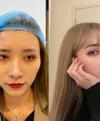 分享:敏感肌的我,是如何在自带妆感的