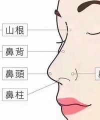 成都刘晶医生讲解:鼻部多项手术恢复期多久?