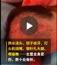 6岁女童遭亲妈及男友虐待险丧命,热水浇头、钳掉牙齿、掰碎胳膊