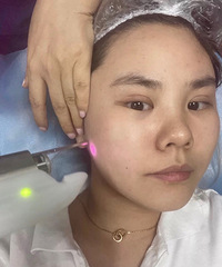 ������P����ʵ��¼����fotona4d�ĶԱȣ�����Ҳ��ѹ��