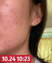 �����������ð��������������ײⶻ����ʧ�ˣ�����ͼ����