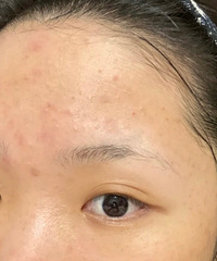 Ϊ�����������2.0��΢�룬��ҽ����˵���Ǹ�����