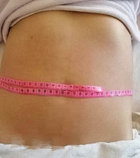 产后4年,980买了30次专治水桶腰套餐,做一次就小了2cm
