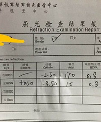 悔不当初,6岁儿子查出高度散光,医生说他这辈子都得戴眼镜
