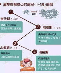 90后宝妈照顾17个月宝宝疱疹性咽颊炎全过程+【护理日记】