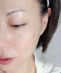 记录我的第一次光子嫩肤,分享真实感受,还发现一个意外的作用…