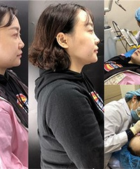 直播来看看很火的“抗衰神器”到底如何