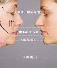 可怕!做完线雕2天后,她随手揪出蛋白线