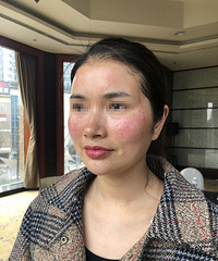 专业皮肤科医生来给大家讲解皮肤问题,这些你必须要知道