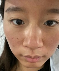 ˸ŵȾϼ⣬ϵĺѪ˿Ͳ