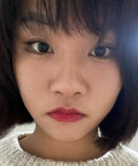 外切鼻翼38天了,鼻子小了感觉脸都小了一圈了~
