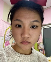 外切鼻翼38天了,鼻子小了感觉脸都小一圈