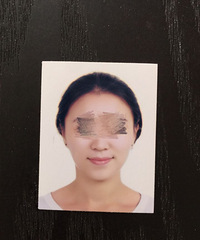 打了瘦脸针之后,别人以为我瘦了10斤