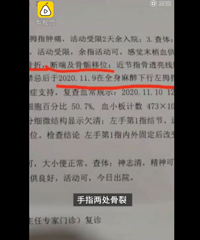 幼师摔打3岁幼童造成孩子手指骨折,对家长撒谎说是被门夹的