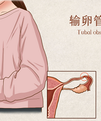 【好孕学堂】久备不孕,何时检查输卵管?输卵管堵塞应该怎么办?