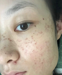 �Ŵ���ȸ��ԭ��Ҳ�ǿ���ȥ���ģ������ǿ����ҵ�Ч��