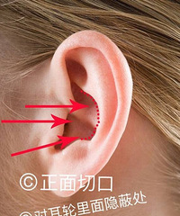 科普来了,被神化了的鼻综合手术,其实真没那么香