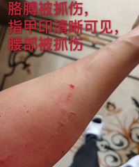 �����Ȼ�Ӧ�ұ���ɹ����ץ��֤��