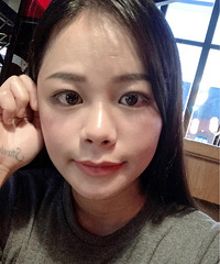 不顾反对做了提眉手术,做完双眼皮明显人也精神好多