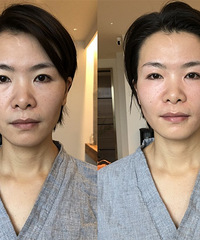 真的吗?不用运动也能瘦肚子,不用整形也能填充面部