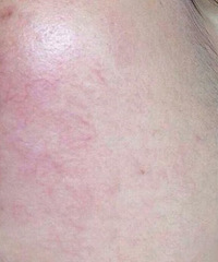 Ѫ˿ԽԽջ𣿽һУ3ͱɾ