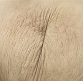 产后的肚皮不忍直视