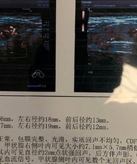 前年底检查出有甲状腺结节没有重视,再去检查医生直接让我切除