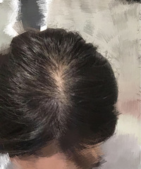 万万没想到,一碗豆浆竟然治好了秃顶
