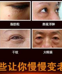 全文干货,建议收藏后观看!聊聊如何去除黑眼圈的问题