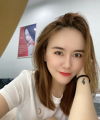 改变了美颜都拯救不了的塌鼻子,都说我像换了个人一样