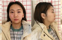 徒手整容原来是真的!超级歪的脸,都能变正了