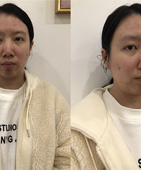 带你体验正宗的韩国皮肤管理,冬季护肤太需要了