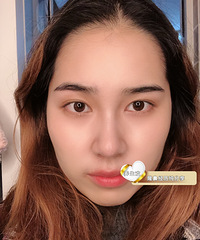 为了有好看的鼻子,做了半年的功课,把我的心得总结出来