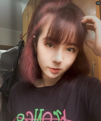 没想到做了双眼皮,不仅变漂亮了还瘦了20斤!来看4个月效果