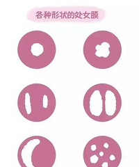 գȥ˽޸ŮĤΪ޸ʲô