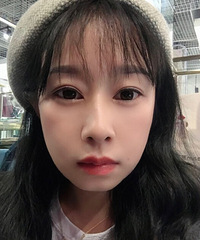30几岁终于消灭掉我的大眼袋,一个月就恢复正常,拍照都好看多了