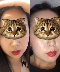 11年2千块的双眼皮正式开启医美之路,说说这些年我做过的项目