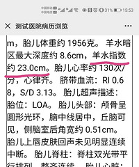 怀孕31周检查出胎儿胸腔积液,宝宝还没出生就做了一场大手术