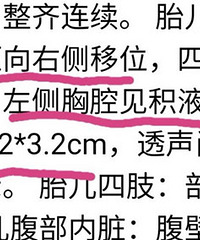 孕期查出胎儿胸腔积液,宝宝还没出生就在肚子里做了一场大手术