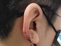 她理发耳朵被剪掉肉