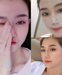 做了“妈生款”双眼皮,亲妈都说很自然