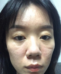 脂肪填充也拯救不了我的印第安纹