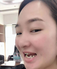 感谢牙卫士,拯救了我这一口参差不齐的烂牙