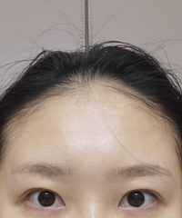 卡姿兰大眼睛,修复我的双眼皮