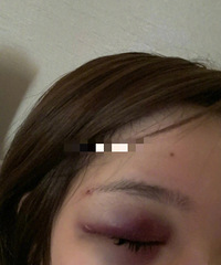 �����������ȣ�Ů�����⻳�к��̥