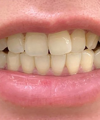 ȻֻҪ45ӣݾܱ5ȣʣûɬ